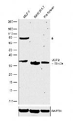 UCP2 Antibody in Western Blot (WB)