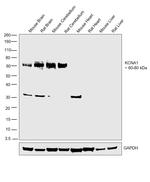 KV1.1 (KCNA1) Antibody in Western Blot (WB)