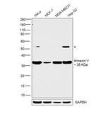 Annexin V Polyclonal Antibody