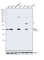 MGMT Polyclonal Antibody