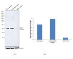 MGMT Antibody in Western Blot (WB)
