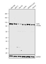 TOP1 Antibody in Western Blot (WB)