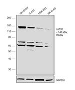 LATS1 Polyclonal Antibody