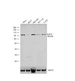 SUZ12 Antibody in Western Blot (WB)