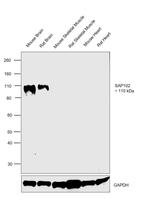 SAP102 Antibody in Western Blot (WB)