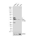 VMP1 Polyclonal Antibody
