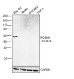 PCSK9 Polyclonal Antibody