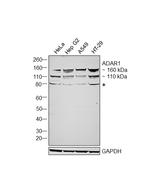 ADAR1 Antibody in Western Blot (WB)
