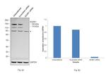 ADAR1 Antibody in Western Blot (WB)