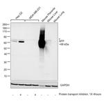 AFP Polyclonal Antibody