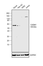 CADM1 Polyclonal Antibody