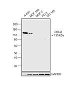 Desmoglein 3 Polyclonal Antibody
