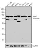 IGF1R (CD221) Antibody in Western Blot (WB)