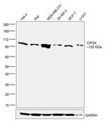 CIP2A Antibody in Western Blot (WB)