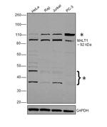 MALT1 Polyclonal Antibody