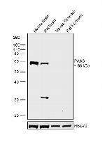 PAK3 Antibody