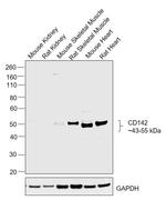 Alpha Sarcoglycan Polyclonal Antibody