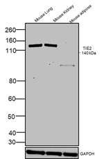 TIE2 (TEK) Antibody