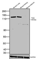TIE2 (TEK) Polyclonal Antibody