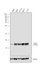 SOD1 Polyclonal Antibody