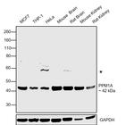 PPM1A Polyclonal Antibody
