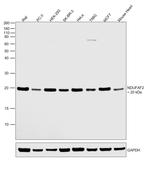 NDUFAF2 Antibody in Western Blot (WB)