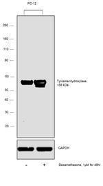 Tyrosine Hydroxylase Antibody