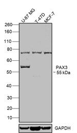 PAX3 Polyclonal Antibody