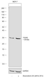 TIGAR Antibody