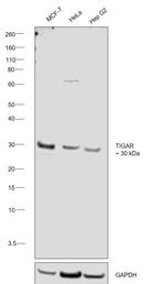 TIGAR Polyclonal Antibody