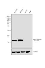 alpha Synuclein Antibody in Western Blot (WB)