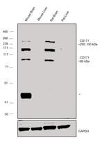 CD171 (L1CAM) Antibody in Western Blot (WB)