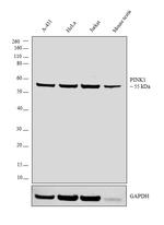 PINK1 Antibody in Western Blot (WB)