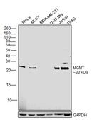 MGMT Antibody in Western Blot (WB)