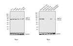 MMP16 Antibody in Western Blot (WB)