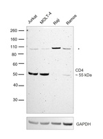 CD4 Antibody in Western Blot (WB)