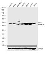 MCT2 Polyclonal Antibody