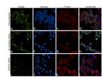 NLRC4 Antibody in Immunocytochemistry (ICC/IF)