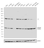 CK2 beta Antibody in Western Blot (WB)