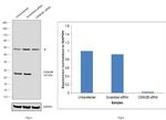 CK2 beta Antibody in Western Blot (WB)