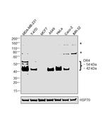 DR4 Polyclonal Antibody