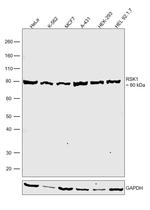 RSK1 Polyclonal Antibody