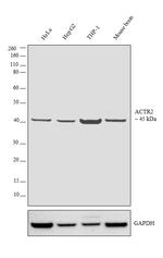 Arp2 Antibody in Western Blot (WB)