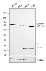 CD2AP Antibody in Western Blot (WB)