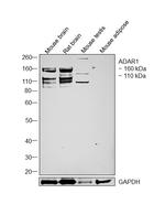 ADAR Antibody in Western Blot (WB)