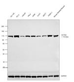 eIF3d Antibody in Western Blot (WB)