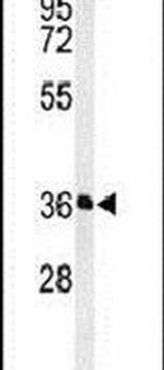 PAAF1 Antibody in Western Blot (WB)