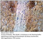 ADCY2 Polyclonal Antibody