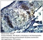 ADCY4 Polyclonal Antibody