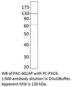 ADCY6 Polyclonal Antibody